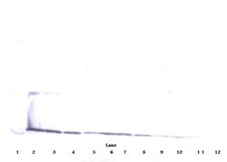 IL-17A Polyclonal Antibody, PeproTech , Invitrogen:Antibodies:Primary Antibodies