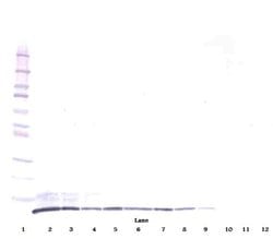 PeproTech CXCL2 Polyclonal Antibody, PeproTech , Invitrogen 1 mg; Unconjugated:Antibodies,