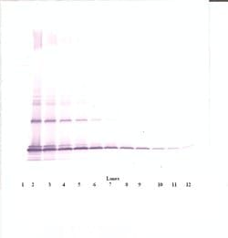 Invitrogen MCP-1 Polyclonal Antibody, PeproTech , Invitrogen 50 &mu;g;