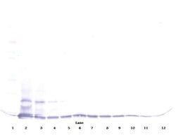 Invitrogen CCL16 Polyclonal Antibody, PeproTech , Invitrogen 50 &mu;g;