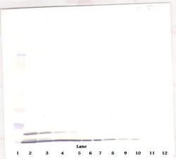 Invitrogen CXCL2 Polyclonal Antibody, PeproTech , Invitrogen 1 mg; Unconjugated:Antibodies,
