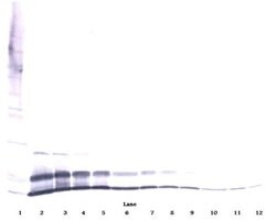 Invitrogen CXCL2 Polyclonal Antibody, PeproTech , Invitrogen 1 mg; Unconjugated:Antibodies,