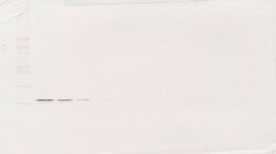 Invitrogen BAFF Polyclonal Antibody, PeproTech , Invitrogen 1 mg; Unconjugated:Antibodies,