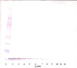 EGF Polyclonal Antibody, Biotin, PeproTech , Invitrogen:Antibodies:Primary