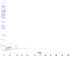 EGF Polyclonal Antibody, Biotin, PeproTech , Invitrogen:Antibodies:Primary
