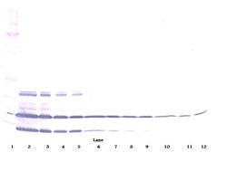 Invitrogen Resistin Polyclonal Antibody, PeproTech , Invitrogen 1 mg; Unconjugated:Antibodies,