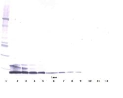 Invitrogen Resistin Polyclonal Antibody, PeproTech , Invitrogen 1 mg; Unconjugated:Antibodies,