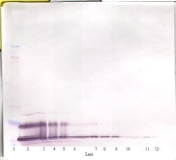 PeproTech CXCL16 Polyclonal Antibody, PeproTech , Invitrogen 50 &mu;g;