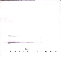 Invitrogen IL-2 Polyclonal Antibody, PeproTech , Invitrogen 100 &mu;g;