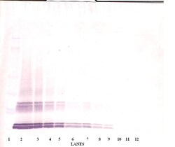 Invitrogen GDF3 Polyclonal Antibody, PeproTech , Invitrogen 1 mg; Unconjugated:Antibodies,