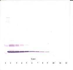 Invitrogen CTGF Polyclonal Antibody, PeproTech , Invitrogen 100 &mu;g;