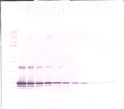 Invitrogen TIMP1 Polyclonal Antibody, PeproTech , Invitrogen 50 &mu;g;