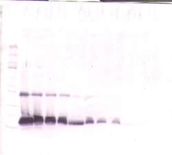 Invitrogen TIMP1 Polyclonal Antibody, PeproTech , Invitrogen 50 &mu;g;