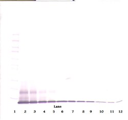Invitrogen CXCL10 Polyclonal Antibody, PeproTech , Invitrogen 100 &mu;g;