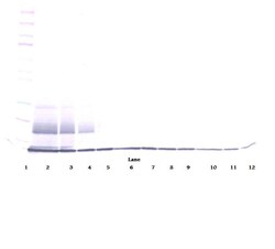 Invitrogen CCL27 Polyclonal Antibody, PeproTech , Invitrogen 1 mg; Unconjugated:Antibodies,