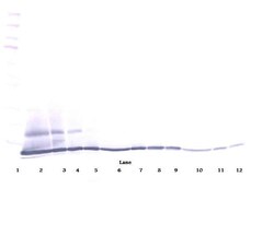 Invitrogen CCL27 Polyclonal Antibody, PeproTech , Invitrogen 1 mg; Unconjugated:Antibodies,