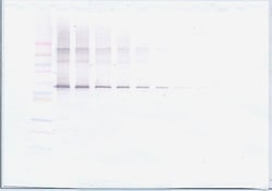 Invitrogen MMP2 Polyclonal Antibody, PeproTech , Invitrogen 1 mg; Unconjugated:Antibodies,