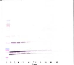 TNF beta Polyclonal Antibody, PeproTech , Invitrogen:Antibodies:Primary