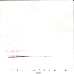 PeproTech Eotaxin Polyclonal Antibody, PeproTech , Invitrogen 1 mg | Buy Online | PeproTech | Fisher Scientific