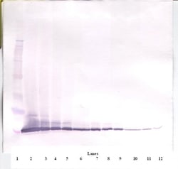 PeproTech Eotaxin Polyclonal Antibody, PeproTech , Invitrogen 1 mg | Buy Online | PeproTech | Fisher Scientific