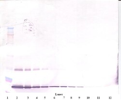 G-CSF Polyclonal Antibody, Biotin, PeproTech , Invitrogen:Antibodies:Primary