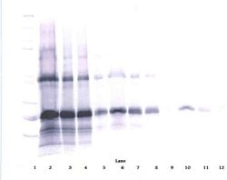 Invitrogen IL-6 Polyclonal Antibody, PeproTech , Invitrogen 100 &mu;g;