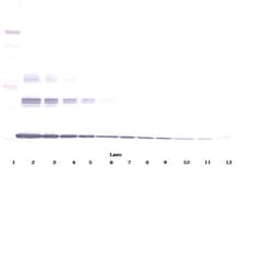 Invitrogen TNF alpha Polyclonal Antibody, PeproTech , Invitrogen 100 &mu;g;