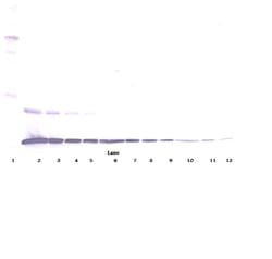 Invitrogen TNF alpha Polyclonal Antibody, PeproTech , Invitrogen 100 &mu;g;