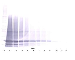 Invitrogen IL-6 Polyclonal Antibody, PeproTech , Invitrogen 100 &mu;g;