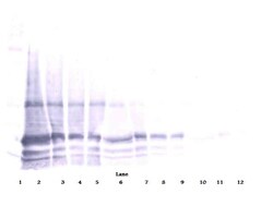Invitrogen IL-6 Polyclonal Antibody, PeproTech , Invitrogen 100 &mu;g;