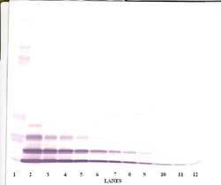 Invitrogen CXCL2 Polyclonal Antibody, PeproTech , Invitrogen 1 mg; Unconjugated:Antibodies,