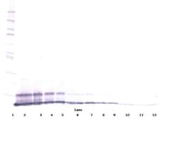 Invitrogen CXCL2 Polyclonal Antibody, PeproTech , Invitrogen 1 mg; Unconjugated:Antibodies,