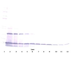 Invitrogen MCP-1 Polyclonal Antibody, PeproTech , Invitrogen 1 mg; Unconjugated:Antibodies,
