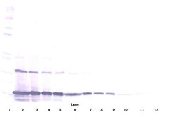 Invitrogen MCP-1 Polyclonal Antibody, PeproTech , Invitrogen 1 mg; Unconjugated:Antibodies,