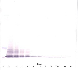 PeproTech CCL3 Polyclonal Antibody, PeproTech , Invitrogen 100 &mu;g; Unconjugated:Antibodies,
