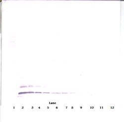 TARC Polyclonal Antibody, PeproTech , Invitrogen:Antibodies:Primary Antibodies