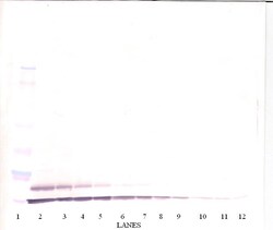 TARC Polyclonal Antibody, PeproTech , Invitrogen:Antibodies:Primary Antibodies