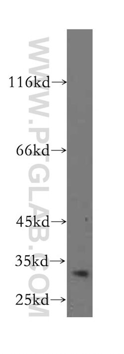 BCL10 Rabbit anti-Human, Mouse, Polyclonal, Proteintech:Antibodies:Primary