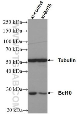 BCL10 Rabbit anti-Human, Mouse, Polyclonal, Proteintech:Antibodies:Primary