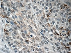 BRD7 Rabbit anti-Human, Mouse, Rat, Polyclonal, Proteintech:Antibodies:Primary