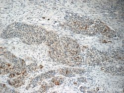 BRD7 Rabbit anti-Human, Mouse, Rat, Polyclonal, Proteintech:Antibodies:Primary
