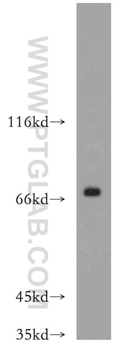 BRD7 Rabbit anti-Human, Mouse, Rat, Polyclonal, Proteintech:Antibodies:Primary
