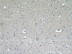 FABP7 Rabbit anti-Human, Polyclonal, Proteintech:Antibodies:Primary Antibodies