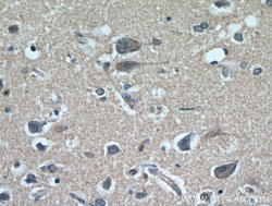 FABP7 Rabbit anti-Human, Polyclonal, Proteintech:Antibodies:Primary Antibodies