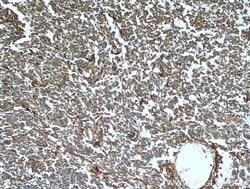Proteintech FABP7 Rabbit anti-Human, Polyclonal, Proteintech