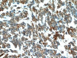FABP7 Rabbit anti-Human, Polyclonal, Proteintech:Antibodies:Primary Antibodies