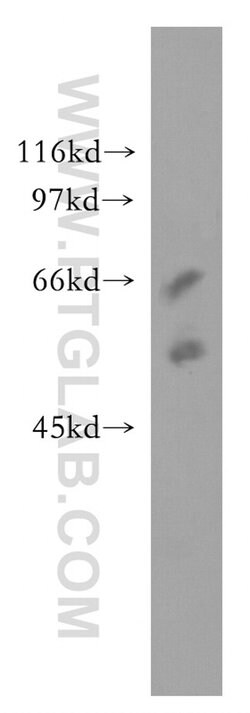 SSTR5 Rabbit anti-Human, Mouse, Polyclonal, Proteintech:Antibodies:Primary