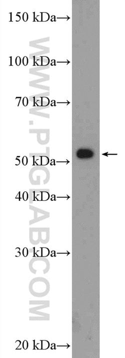 RAD23A Rabbit anti-Human, Mouse, Rat, Polyclonal, Proteintech:Antibodies:Primary