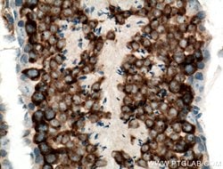 DDX4/VASA Rabbit anti-Human, Mouse, Polyclonal, Proteintech:Antibodies:Primary