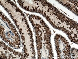 DDX4/VASA Rabbit anti-Human, Mouse, Polyclonal, Proteintech:Antibodies:Primary